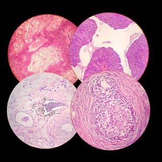 Anatomía patologíca
