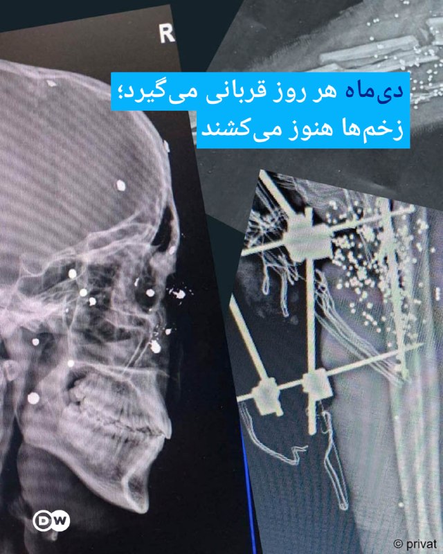 DW Persian دویچه‌‌وله فارسی ✔: 🔶 دی‌ماه هر روز قربانی می‌گیرد؛ زخم‌ها هنوز می‌کشند🔻گزارشی از آتفه چهارمحالیاندی‌ماه در تن‌ها و زخم‌ها ادامه دارد. گلوله