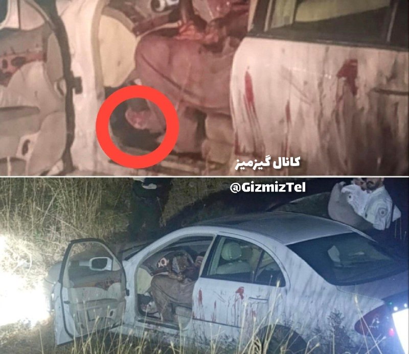 عصرتعادل: امروز توی سنندج یه پسر جوون که راننده بنز بوده، مورد حمله چند نفر قرار میگیره و دستش رو از آرنج به طور کامل قطع میکنن و