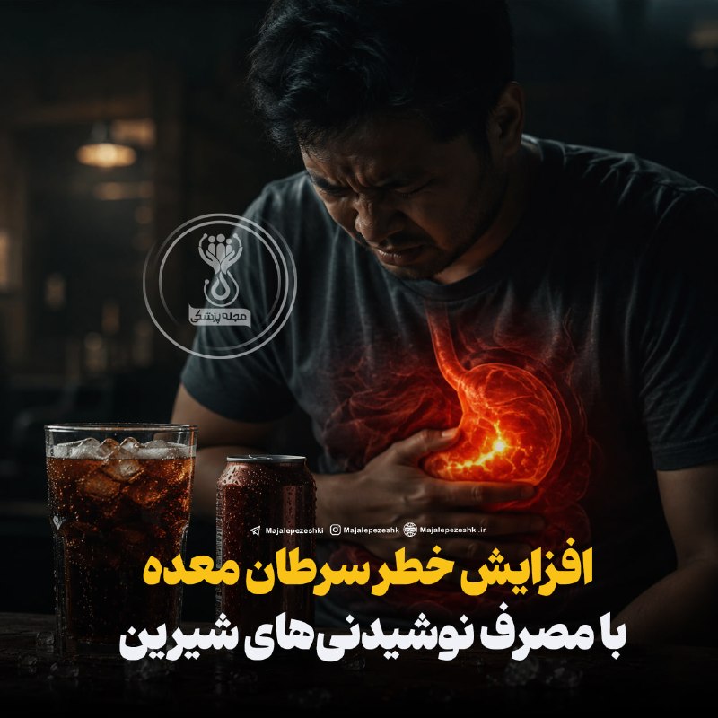 مرصاد نیوز | MERSAD News: افزایش خطر سرطان معده با مصرف نوشیدنیهای شیرین◽️وبگاه سایِنس اَلِرت: یک مطالعه گسترده نشان داده است که مصرف روزانه نوشی