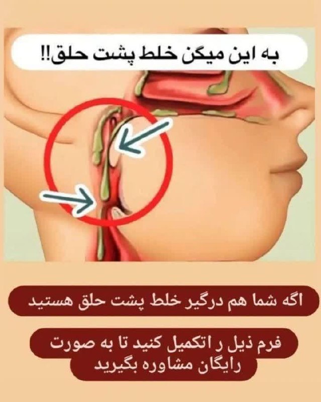 💚 زندگی و سلامتی💚: خلط پشت حلق یا بلغماین عارضه و خلط پشت حلق همون دلیل سفیدی زبان، کمکاری تیروییدنفخ معده، سردی روده و یبوست شدید، درد مفا
