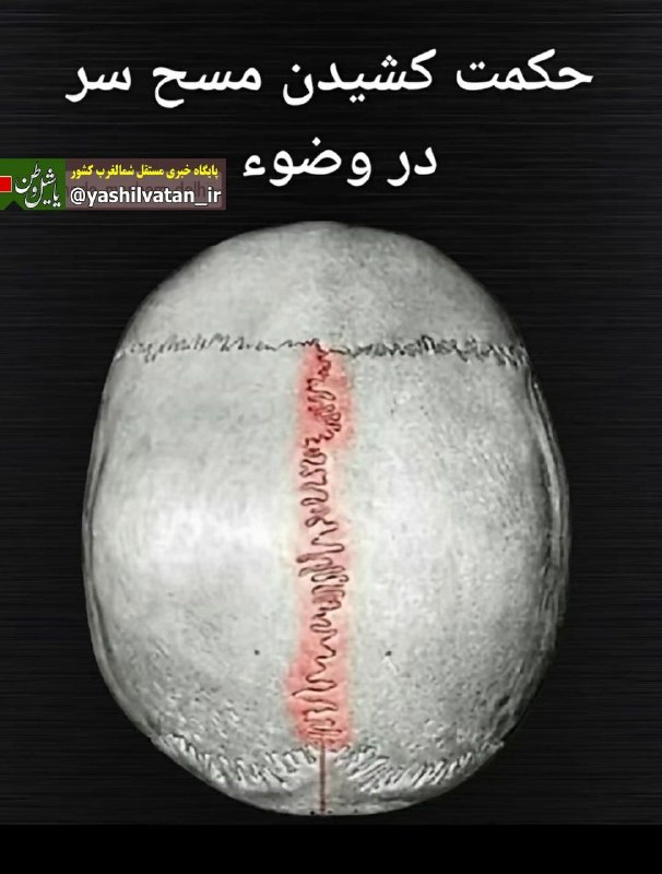 یاشیل وطن _ اخبار روز: 🔰در جمجمه یک درز و شکاف وجود دارد که در منابع طب سنتی به آن یافوخ و در طب نوین درز ساژیتال گفته میشود.وموجب خشکی مغز؛کم