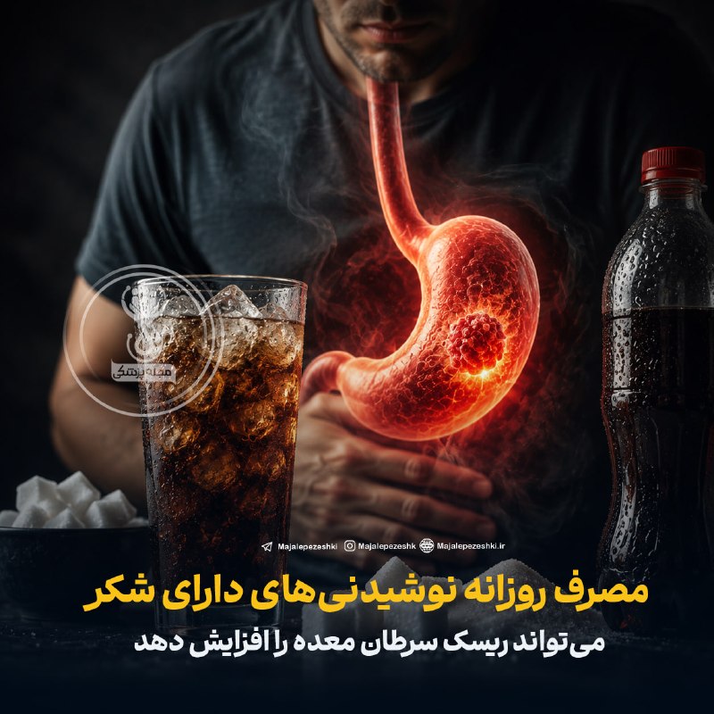 پایگاه خبری سلام پاوه: 💢 مصرف روزانه نوشیدنیهای دارای شکر میتواند ریسک سرطان معده را افزایش دهد🔺 پژوهشگران دریافتند افرادی که روزانه یک وعده