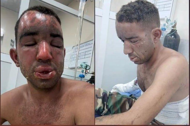 🚨🚨 בהתקפות האחרונות של משמרות המהפכה על עמדות מפלגת קומולה, נעשה שימוש בפצצת זרחן לבן וניתן לראות את העדו…