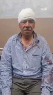"While I went to pray, they sprayed me with pepper spray, and they hit me in the head and eyes."