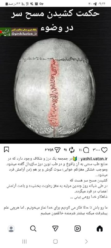 ماموستا عثمان ساعدی: حکمت کشیدن مسح سر وقت وضوء( سبحان جل خالق)✅ تلگرام: کانال اصلیhttps://t.me/osmansaeede✅ تلگرام : آرشیو خطبه ها:https://t