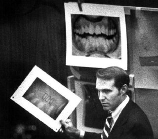 One of the main pieces of evidence against Ted Bundy (an American serial killer, rapist, kidnapper, and necrophiliac who was active in the 1970s) was his teeth.He bit his victims on the breasts and buttocks. He even bit off one victim's nipples.Time Machin