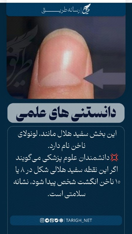 Tarigh | طریق: این بخش سفید هلال مانند، لونولای ناخن نام دارد.💢دانشمندان علوم پزشکی میگویند اگر این نقطه سفید هلالی شکل در ۸ یا ۱۰ ناخ