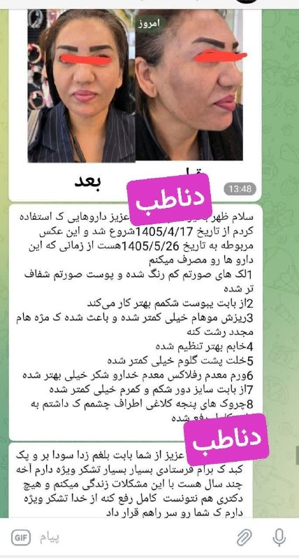 🌱🌱اندام جذاب🌱🌱: رضایت تصویری عالی مشتری گلم بابت پک کبد ، قرص سودابر و قرص بلغم زدای دناطب😍😍😍اگه محصولات تخصصی دناطب معجزه نیس پس چیه؟دن