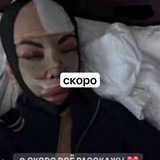 . ЧИСТКА