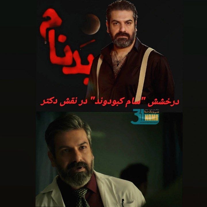 31nama: "سام کبودوند" در نقش یک متخصص مغز و اعصاب سریال بدنام انقدر بازیِ درجهِ یکی دارد که مخاطب اگر اهلِ تئاتر نباشد و چهرهی