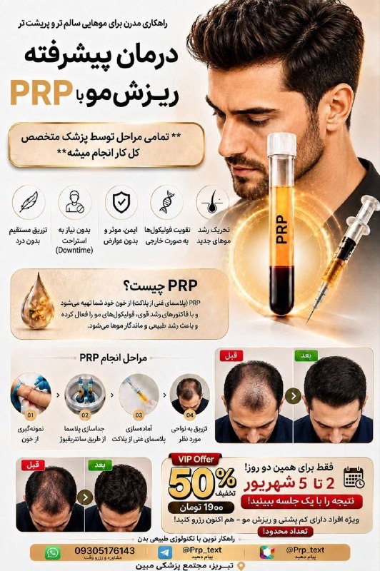 تبریز خبرلری ✔️: 🔬پی آر پی مو ترندِ این روزهای دنیای زیبایی✅️روش نوین برای کمک به تقویت ریشه مو و داشتن موهایی پرپشت تر و شاداب تر💉پی آر