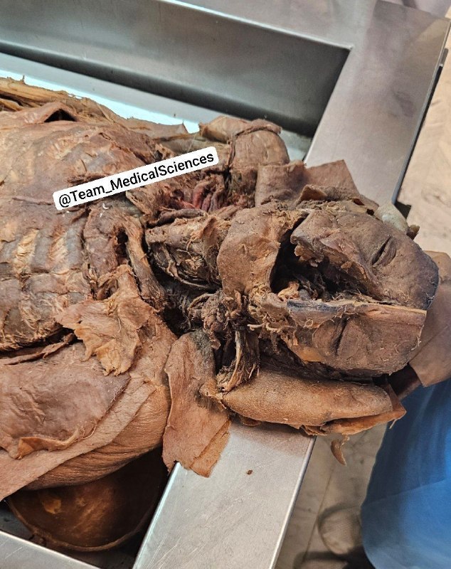 دانشــ🎓ــجو: 💀 تشریح جسد🔴 دانشجویان علوم پزشکی وارد شوند :👇https://t.me/Team_MedicalSciences/2458