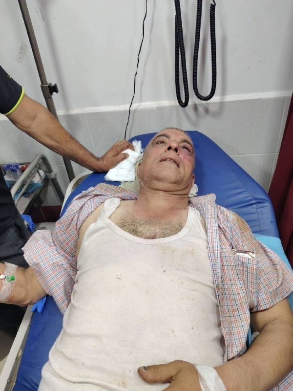 תקיפה אכזרית וברברית... השפעות תקיפת המתנחלים על חבר עיריית בית פוריק, איברהים חתחתבה באזור טנא אלפוקה, מזר…