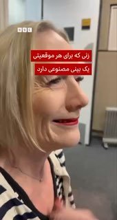 ג'יין הארדמן, 48, מווסטרשייר, בריטניה, אובחנה כחולה במחלה אוטואימונית נדירה בשם וסקוליטיס, והרופאים נאלצו ל…