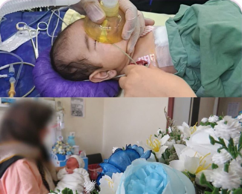 ایرنا سمنان: 🔗نجات نوزاد ۲ماهه با پارگی طحال در سمنان و تولد هشتمین فرزند مادر شاهرودی🔹تیم پزشکی در بیمارستان کوثر سمنان با انجام جرا