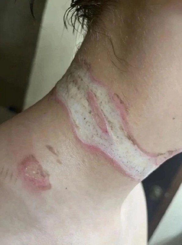 В Штатах произошел инцидент шестнадцатилетний Рейс Огдал, оставив свой смартфон на зарядке на кровати, заснул. Во время сна, совершая движения, он ... - изображение 2 - кровати, штатах, произошел