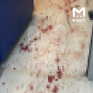 Неизвестный с ножом ворвался в больницу и напал на трёх врачей в Махачкале. Один в тяжёлом состоянии — предварительно, ему порезали горло и лицо.По данным Mash, конфликт вспыхнул в центральном медучреждении. Предварительно, мужчина разозлился из-за того, ч