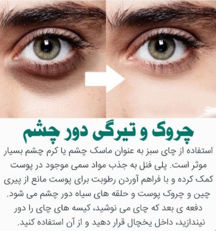 درمانگاه طب اسلامی گیاهی شفا: ↻ چروک و تیرگی دور چشم ❍ استفاده از چای سبز به عنوان ماسک چشم یا کرم چشم بسیار موثر است. پلی فنل به جذب مواد سمی موجود د