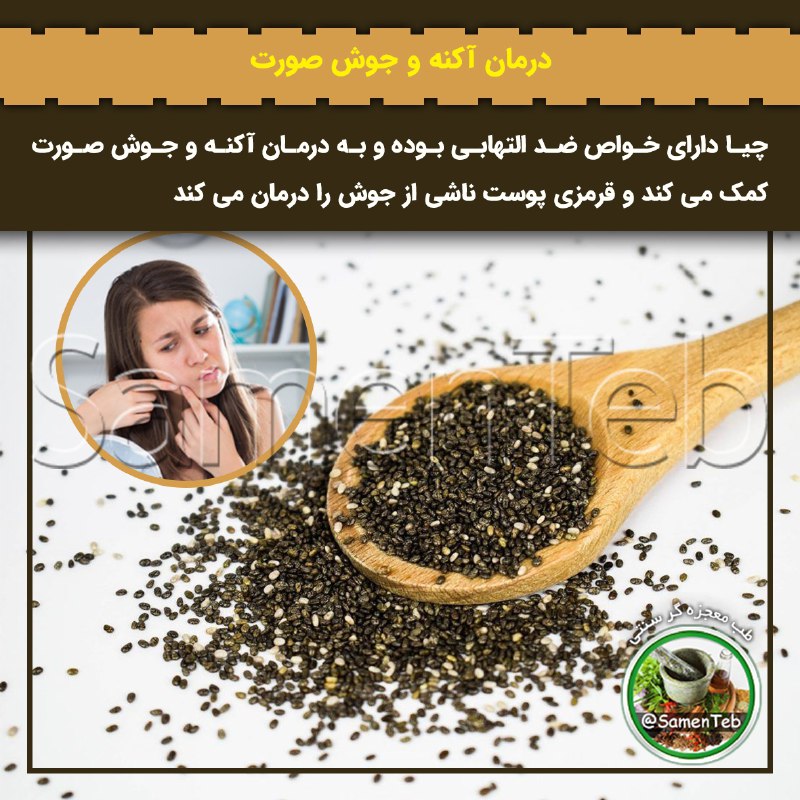 🍃طبِ معجزه‌گرِ سنتی🍂: ✅ درمان #آکنه و #جوش صورت⬅️ چیا دارای خواص ضد التهابی بوده و به درمان آکنه و جوش صورت کمک می کند و قرمزی پوست ناشی از جو