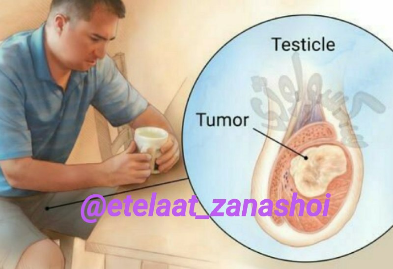 زندگی زناشویی |تکنیکهای همسرداری|: 💥بیضه آقایان جزو 5 عضو اول آسیب پذیر بدنشان میباشد.دمای بالا و ضربه شدید میتواند برای همیشه کارایی آنها که همانا نقش اصل