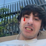 EL RVSO