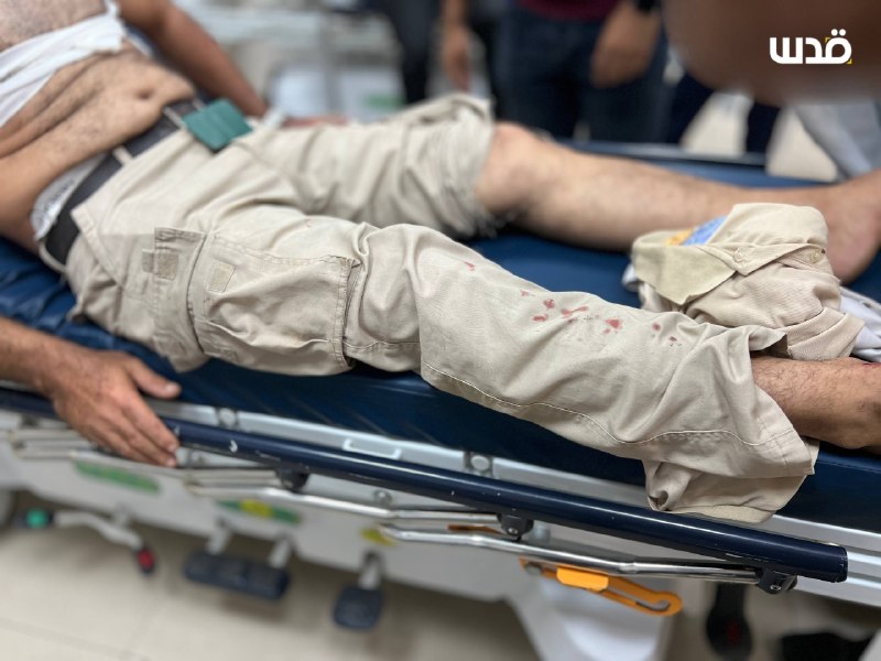 Urgent: We wrote: Two wounded, one of them human, in the bombing of an occupation drone in the vicinity of Tayba Towers, west of Khan Yunis, south of the Gaza Strip.
