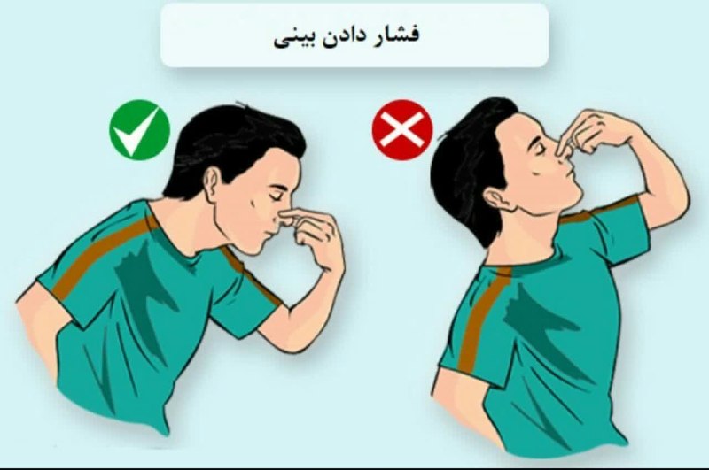 مزاج شناسی: .🔻خون دماغ شدن 👇🏻✅ معمولا معلول #غلبه_دم(خون) است🔹البته برای #صفراوی_مزاج ها هم خونریزی مویرگ های بینی اتفاق می افتد💠درم