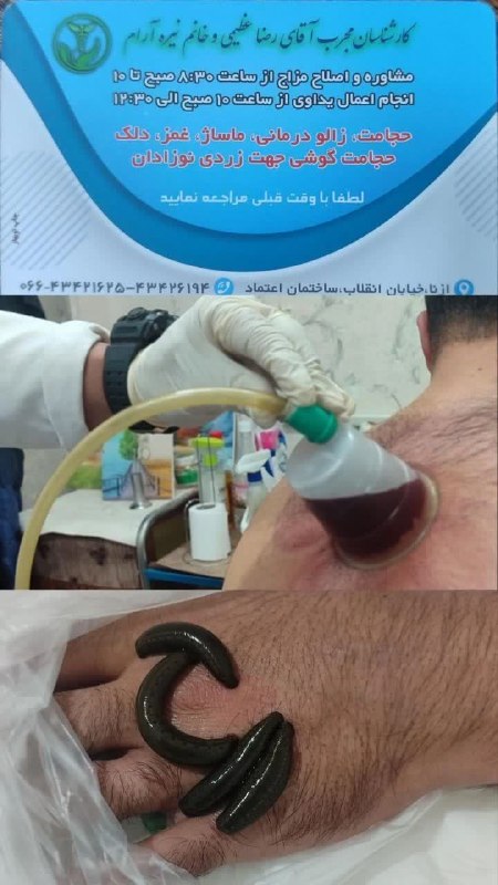 نیوز الیگودرز: #حجامت_ازنامطب دکتر رضا رضاییآماده ارائه خدمات طب سنتی_ایرانیحجامت،حجامت چینی، زالو درمانی،ماساژ،طب سوزنی،... بههمشهریان