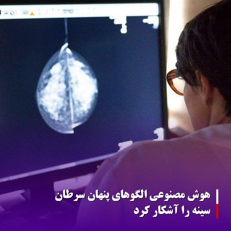خبرگزاری بین المللی شفقنا: 🔴هوش مصنوعی الگوهای پنهان سرطان سینه را آشکار کرد⬅️به گزارش سرویس ترجمه شفقنا، محققان دانشگاه ساوتهمپتون با توسعه یک ابز