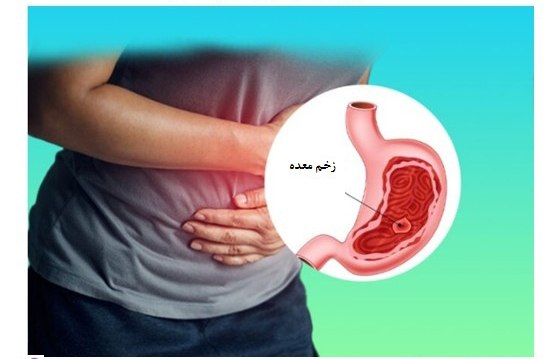 خبرفوری: ✅ اگر زخم معده دارین، صبحها شیر نخورین !🔹شیر به علت داشتن کلسیم، محرک اسید معده است و باعث رفلاکس و سوزش معده شما میشود
