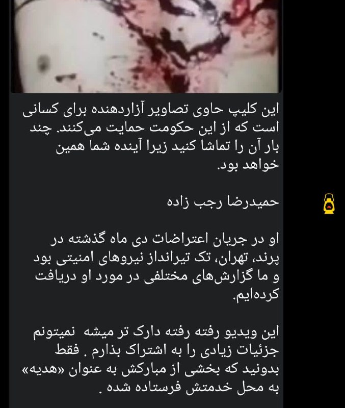 💥درحاشیه(اخبارداغ هنرمندان): 🔰🔰🔰بخشی از بدن حمیدرضا رجب زاده رو فرستادن محل کارش. بعد اینا، به بسیجی می‌گن داع*شی!بسیجی‌ای که ۱۸ و ۱۹ دی با باتوم تام