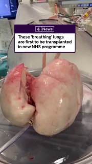 The NHS in UK is testing a new organ transplant system that could completely change how donated organs are used.Science and facts💡