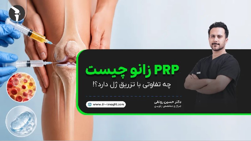 دکتر حسین رونقی متخصص جراحی ارتوپدی: PRP زانو چیست و چه تفاوتی با تزریق ژل داردتحقیقات سازمان جهانی بهداشت نشان میدهد که آرتروز زانو یکی از 10 عامل اصلی نات