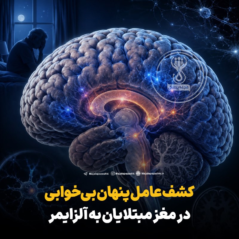 آخرین خبر مازندران: ♦️کشف عامل پنهان بیخوابی در مغز مبتلایان به آلزایمر◽️پژوهشگران با مطالعه روی موشها به این نتیجه رسیدند که سلولهای ایم