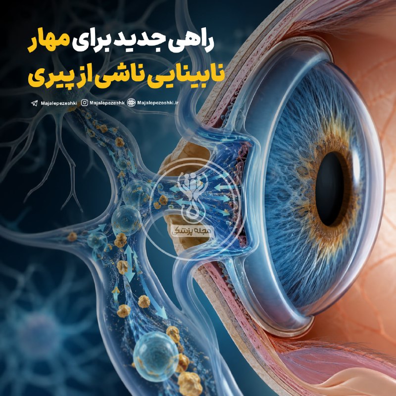 دکتر خودمان باشیم: راهی جدید برای مهار نابینایی ناشی از پیری◽️دانشمندان مسیر زهکشی جدیدی در پشت شبکیه کشف کردهاند که نشان میدهد رگهای لن