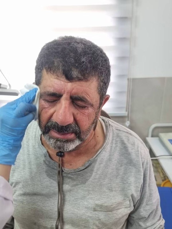 מיליציות המתנחלים של ישראל היכו באכזריות חקלאים פלסטינים באזור ג'רעא של העיירה ג'מיין, דרומית לשכם.