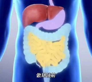 「医学科普：结肠镜检查（Colonoscopy）」@knowledge1024