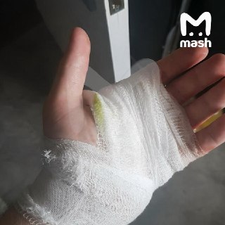 Химловушка "Кукла" взорвалась в руках у школьника в Перми. 13-летний подросток получил ожог от краски, распылившейся после детонации устройства.По данным Mash, такая пиротехника стоит около 1,5к рублей. Разброс химической краски — не меньше полутора метров