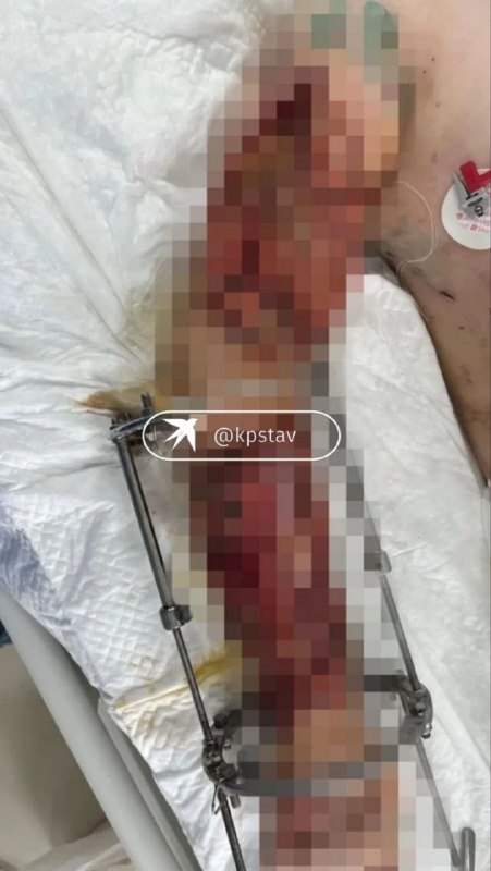 Image from a post by Нетипичный Ставрополь️