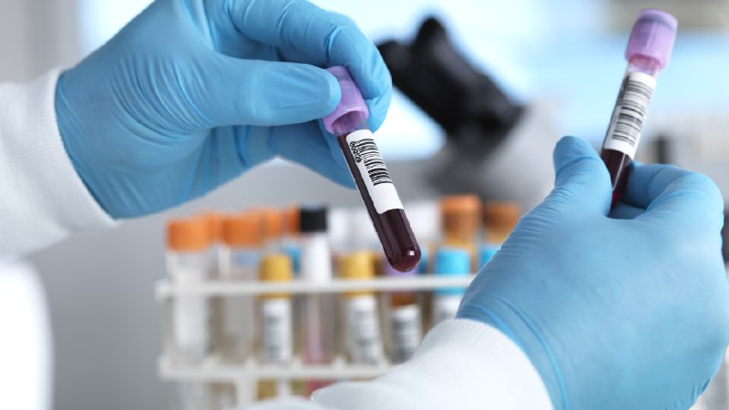 More and more older Americans want to know their Alzheimer's status, survey finds