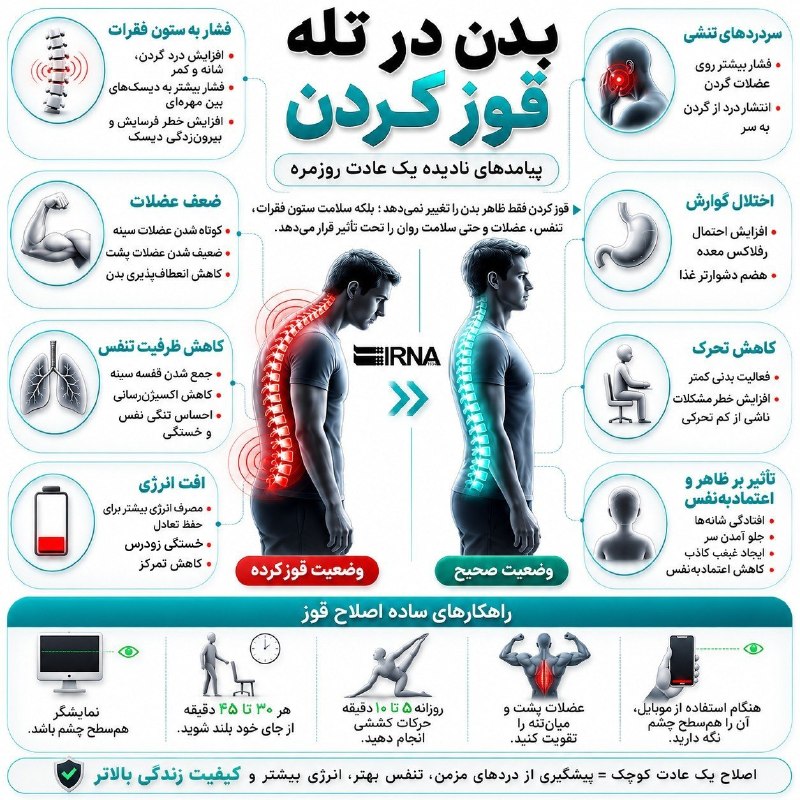 📋מידע על גוף IRNA במלכודת סקוואט