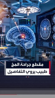 The moment when the tremor disappeared on the operating table... How did an Egyptian doctor end 10 years of suffering?