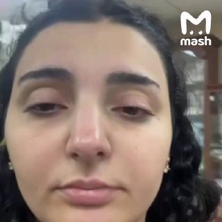 Жительница Тюмени утверждает, что получила ожог роговицы и светобоязнь после термогеля для ресниц известной марки PUSY. Она вынуждена ходить в очках из-за отёков и покраснений, а бренд предложил 15к, чтобы замять дело. 27-летняя Диана купила гель в интерне
