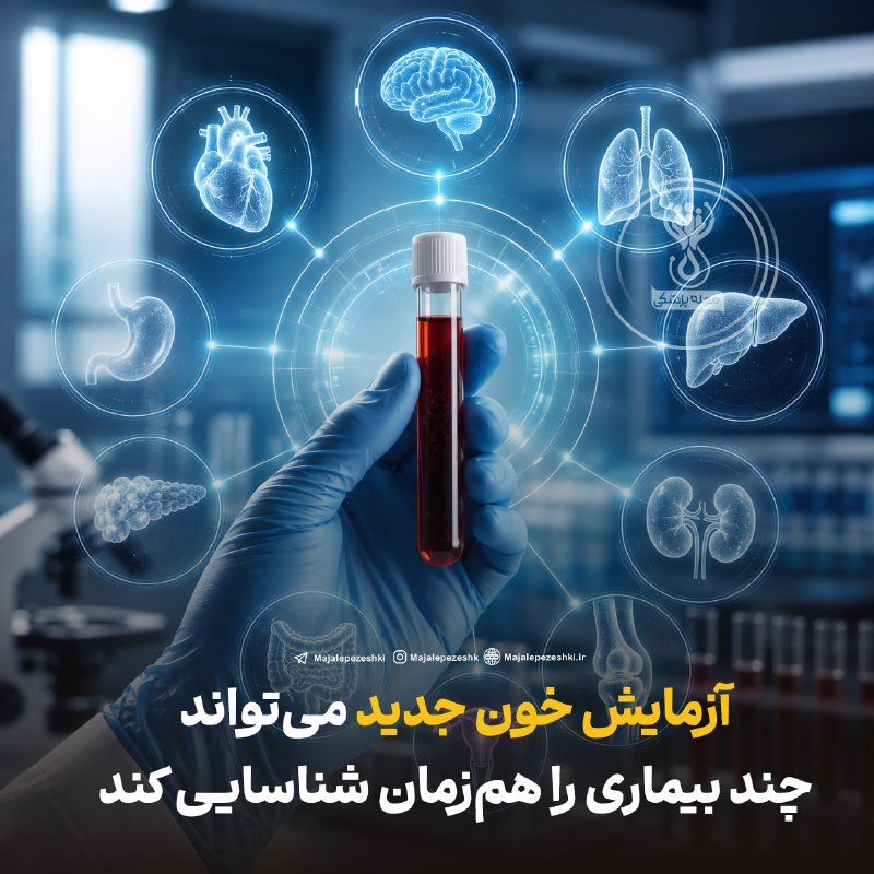 مجله پزشکی: آزمایش خون جدید میتواند چند بیماری را همزمان شناسایی کند🩸◽️پژوهشگران UCLA آزمایش خون جدیدی توسعه دادهاند که با بررسی