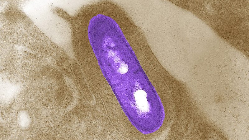 Listeria outbreak linked to recalled prepared foods hospitalizes 10