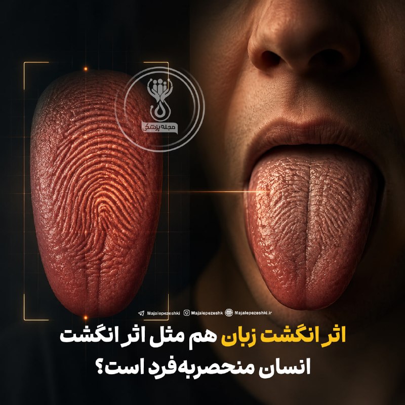 مجله پزشکی: اثر انگشت زبان هم مثل اثر انگشت انسان منحصر‌به‌فرد است؟◽️ساختار زبان هر فرد شامل ویژگی‌های آناتومیکی متفاوتی است؛ اما بر
