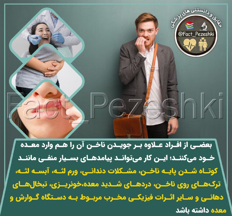 ❣ ترفند│Tarfand ❣: ⚠️بعضی از افراد علاوه بر جویدن ناخن آن را هم وارد معده خود میکنند این کار میتواند پیامدهای بسیار منفی مانند ✖️کوتاه ش