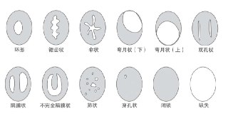 今天分享一个关于阴道瓣（处女膜）的冷知识其实它和我们的胸部一样也分为不同的形状，它总共分为十二种形状。分别是：环形、锯齿形、伞形、弯月形上、弯月形下、双孔形、隔膜形、不完全隔膜形、筛形、穿孔形、闭锁、缺失。在阴道口和阴道前庭的交界处有一层环形的膜，中间有孔，就是我们俗称的处女膜，学名叫阴道瓣。为了说明方便，我们统一使用“处女膜”这个词。所以希望大家能够重新认识这个新名词它是阴道瓣，而不是“处女膜”。剧烈的运动，比如跳高、跳鞍马、骑自行车，都有可能造成破裂。处女膜周围存在少量的血管和神经，所以初次同房可能会造