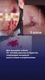 ❗️❗️ TW: насилиеДве женщины избили самокатом 14-летнюю девочку из Бурятии. Нападание они сопровождали расистскими оскорблениямиНападение произошло 26 мая в московском ЖК «Саларьево». По словам матери пострадавшей, ее 14-летняя дочь пришла в гости к подруге